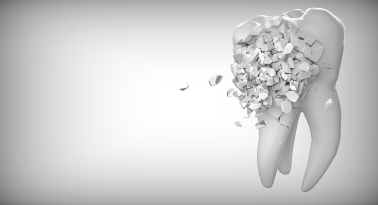 tratament ortodontic pentru corectarea poziției dinților